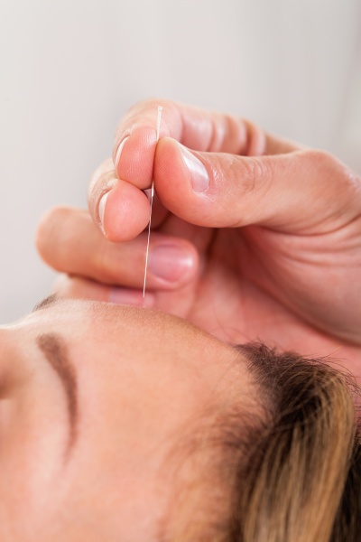 frau unterziehen akupunktur behandlung