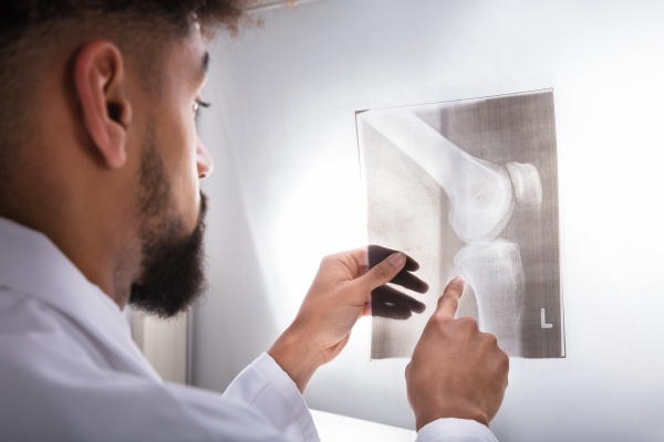 doktor examining knee x ray