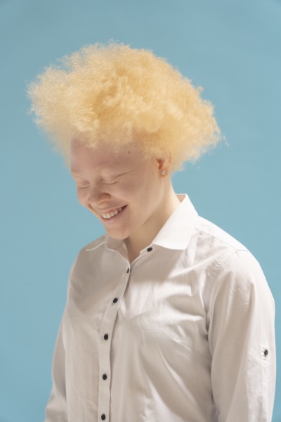 studioportraet einer laechelnden albino frau im