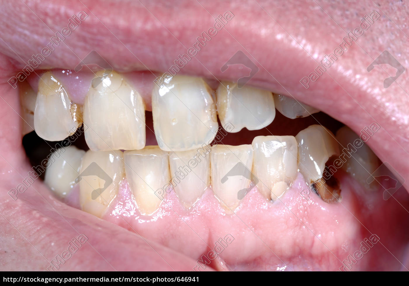 Mit schlechte 30 zähne Schlechte Zähne