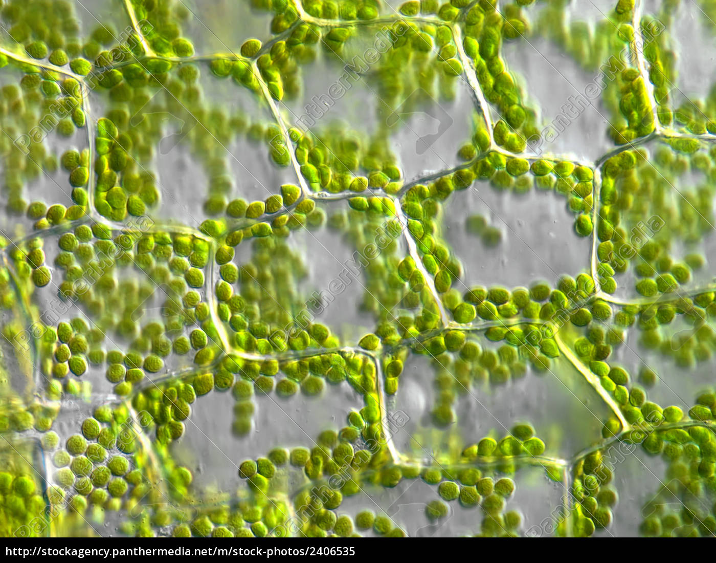  Pflanzenzellen  mit Chloroplasten mikroskopisch 
