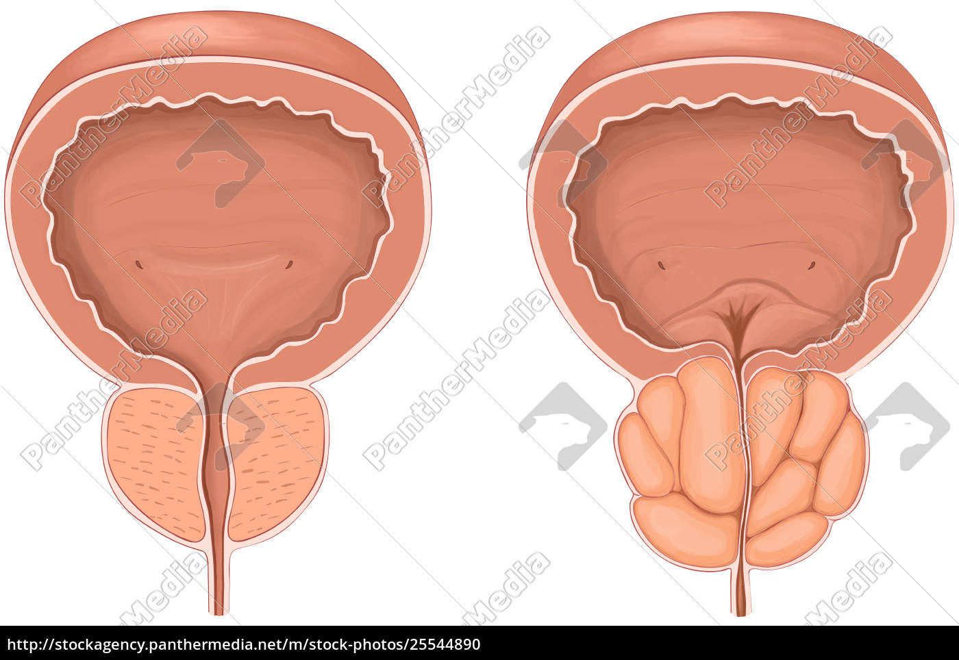 Vorderansicht Zeigt Normale Versus Vergrosserte Stock Photo Bildagentur Panthermedia